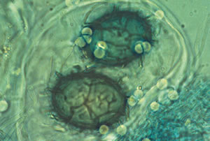 Ascosporas de Tuber melanosporum