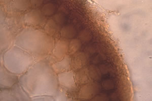 Corte transversal de micorriza de Pisolithus tinctorius y Pseudotsuga menziesii.